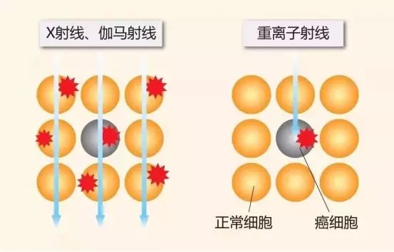 質(zhì)子重離子技術(shù)醫(yī)療險可以報銷嗎？